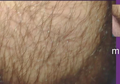 The Texture of the Clothes