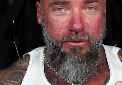 How to Stop Sexual Performance Anxiety