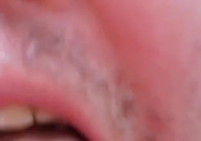 Camera Blunder in the Attempt at Facial Insemination