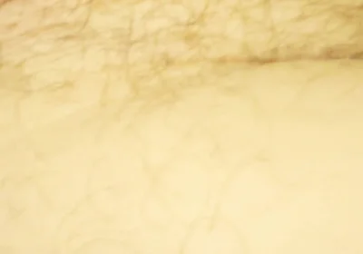 Close up of My Hole