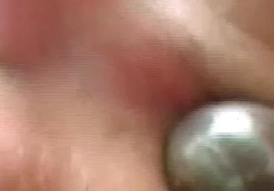 Gaping Anal Rosebud Prolapsing After Deep Stretching Session