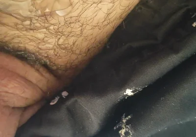 Uncircumcised Phimosis Has the First Ejaculation.