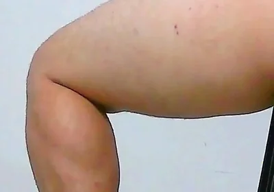 Oh, My Ass Hurts, Apply Ointment