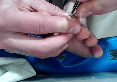 My Feet Stink and My Nails