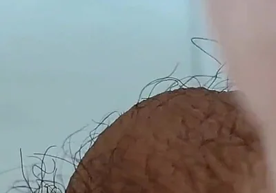 Extreme Open Hole Leaves the Glans Exposed.