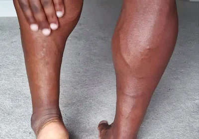 For My Feet Lovers