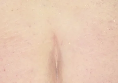 How I Stretch My Asshole for Fisting