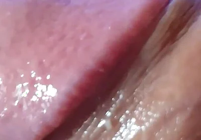 Strange Lumpy Cock with a Gigantic Head.