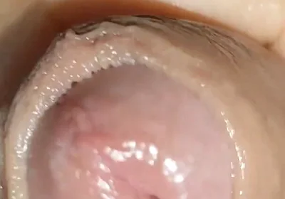 Growth Technique for Soft Cock Sold Out in 30 Seconds.
