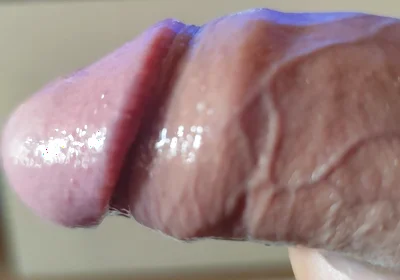 Strange Lumpy Cock with a Gigantic Head.