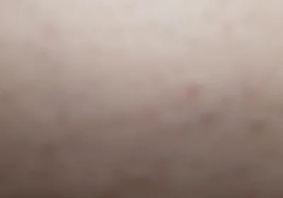 You Suck Me POV