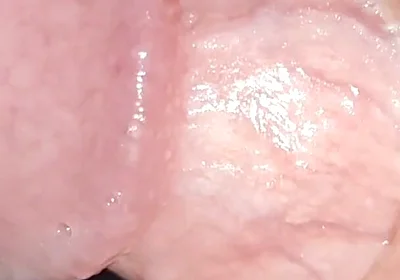 Incredible Cock, Unique of Slippery Phimosis by the Robust Body.