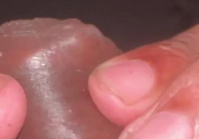 Forskin Play & My Thick Veiny Cock Shooting a Massive Creamy Load