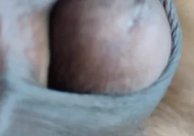 My Penis