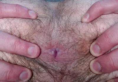 By Popular Demand, I Farted and Showed My Hairy Ass.