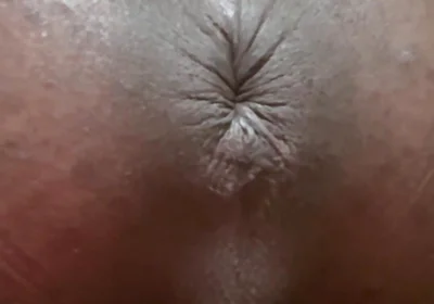 Hello, I Today. We Want to Have Sex with Me Again? I Want to Fart on Your Cock