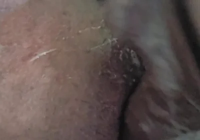 Closeup of My Ass!