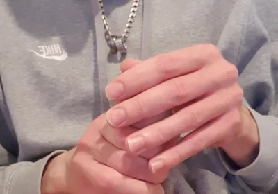 Skinny Lad Pulls Back Skin to Show Bellend