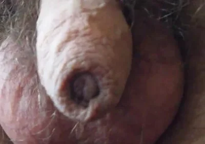 My Penis Walkabout