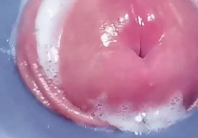 Penis Machine with a New Attachment