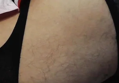 Rot Couch