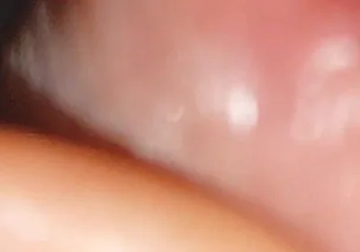 Hot Daddy in Close-up of the Inside of the Glans!