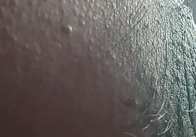Armpit
