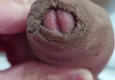 The Head of My Penis