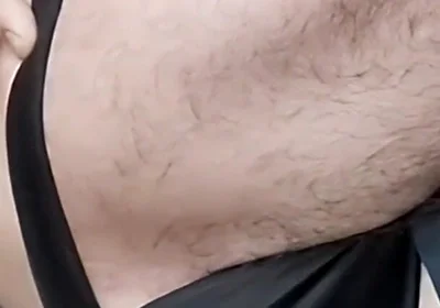 A Sperm Injection
