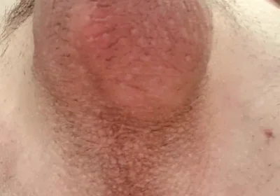 Do You Like Shaved or Hairy?