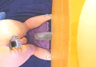 Extreme Anal - Huge Speculum Keeps Femboy Ass Opened
