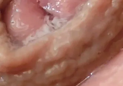 Juice From the Glans When Excited to the Extreme.