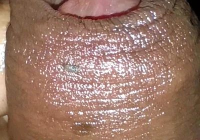 Close-up of Foreskin and Ejaculation in My Pants