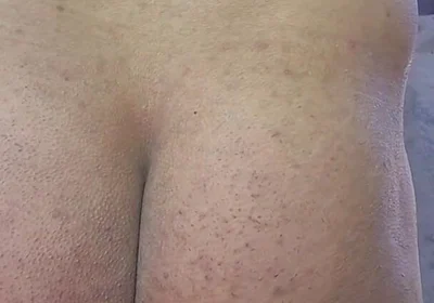 First Time Using an Inflatable Anal Ball