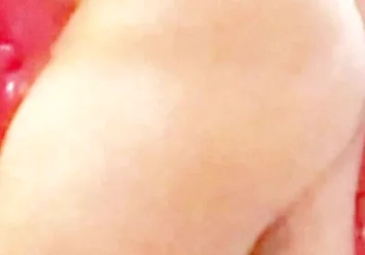 Whip-lash