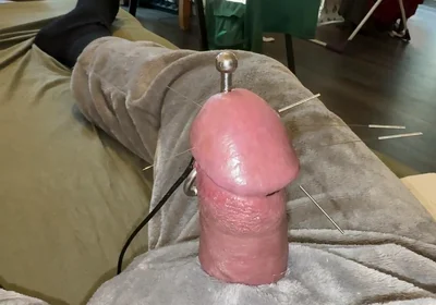 Acorn Acupuncture in a Cozy Cuddly Suit! Lots of Sperm!