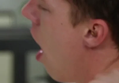 Exposed