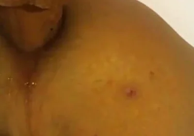 Deep in the Butt