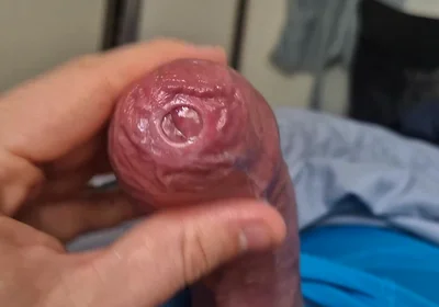 Phimosis Cock Precum Drip Close-up