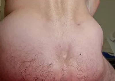 Extreme Anal Stretching With My Huge Blue Egg Plug