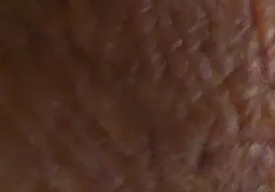 Closeup Desi Dick