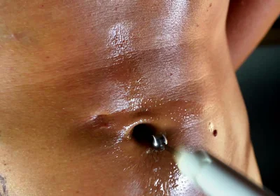Navel Takes the Machine. From Slow Stretch to Hard Rhythm