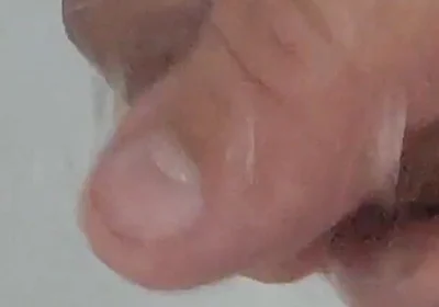 Strong Water in the Foreskin Excites the Glans Precum.