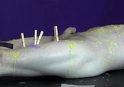Pinching pegs leave welts