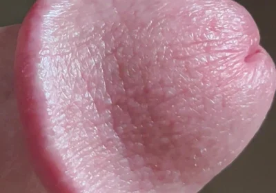 Closeup of Penis with One Vein