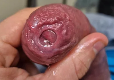 Uncut Head Precum Play