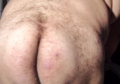 Fat Obese Butt