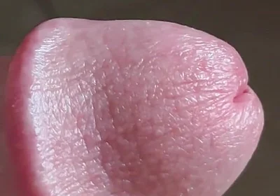 Closeup of Penis with One Vein