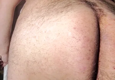 Fat Obese Butt