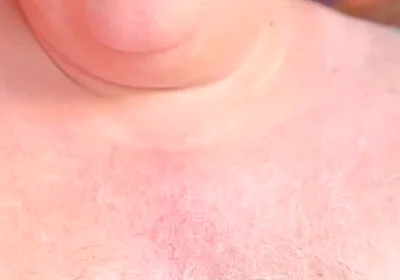 Old Man with Thickest Mushroom Penis